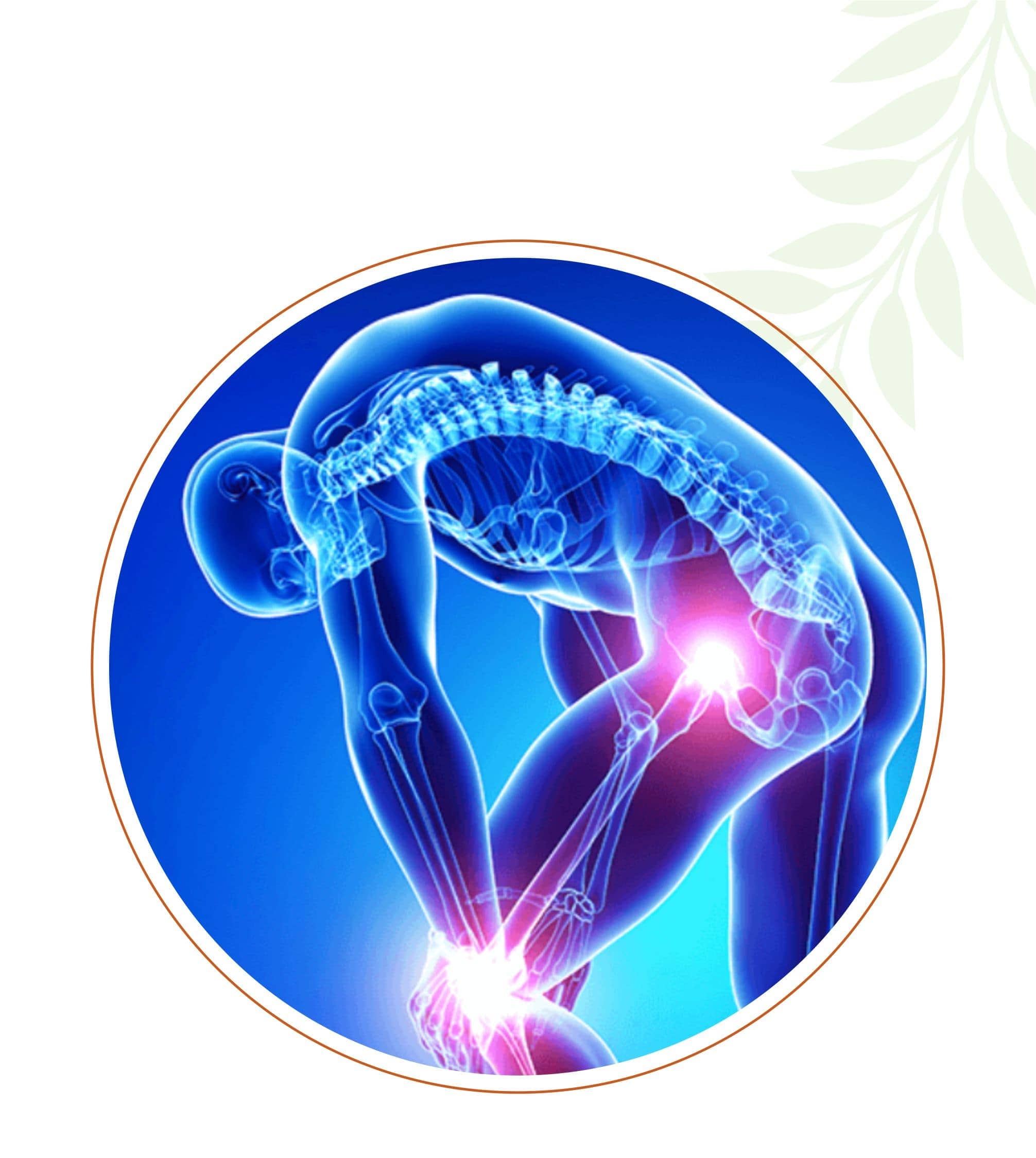 Artharitis